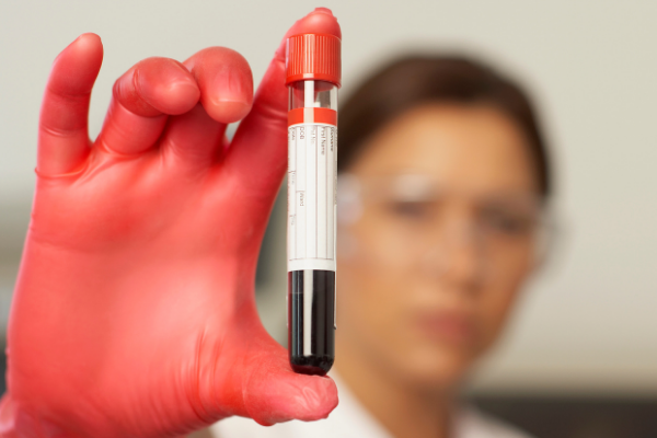 Sickle Cell Disease